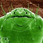 تا حالا عكس شپش رو ديدين؟؟؟