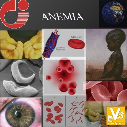 anemia2