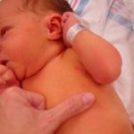 همه چيز درباره زردي نوزادان