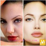 تصاوير ناديده اي از آنجلینا جولی قبل و بعد از جراحی پلاستیک
