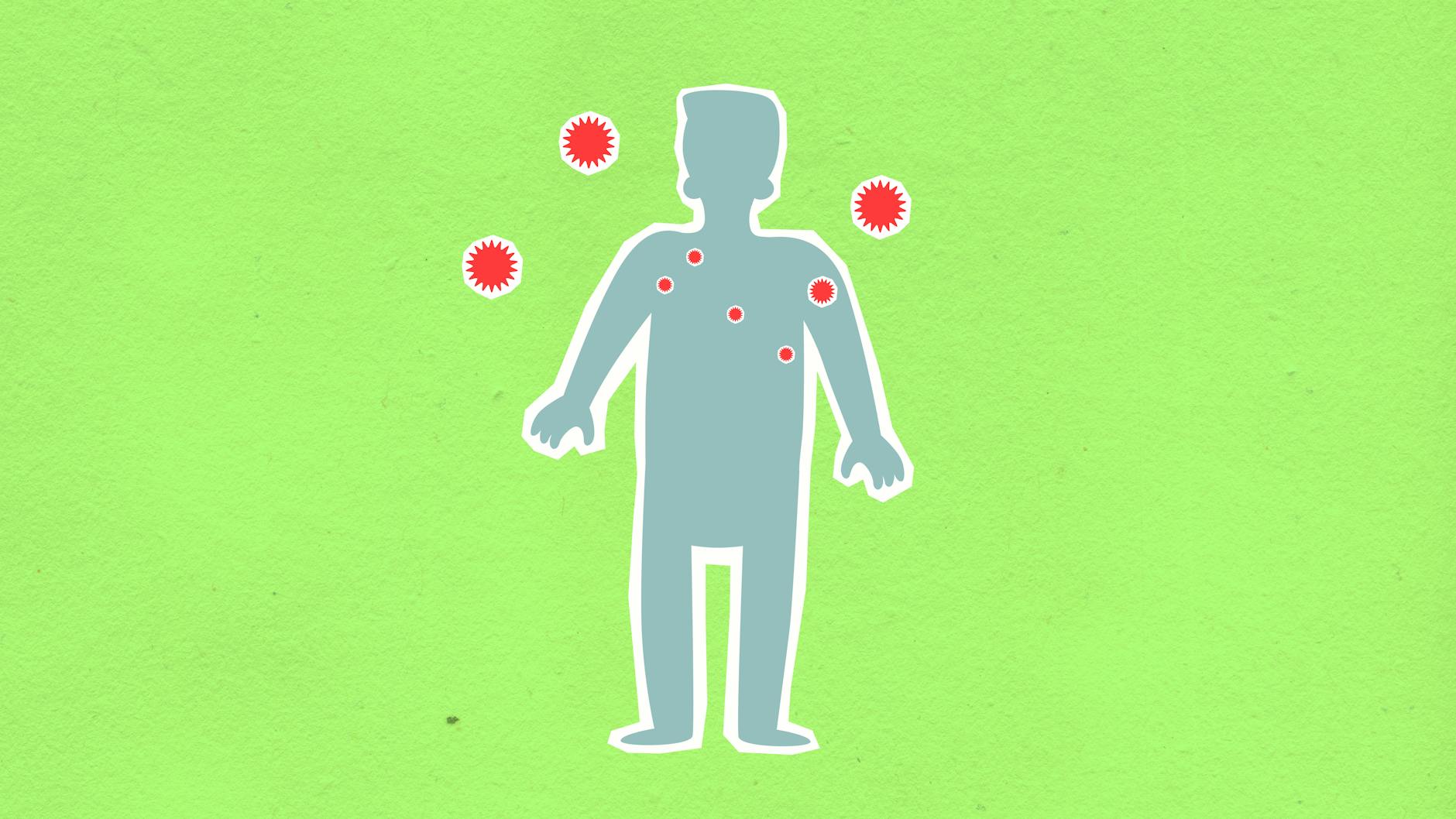 نمودار علائم عفونت قارچی واژن