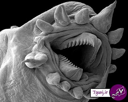 نوعي کرم دریایی از زير ميكروسكوپ
