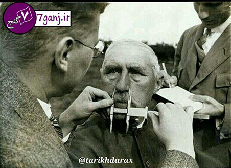 اندازه گيري بيني براي تشخيص ي