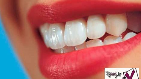 سلامت دندان