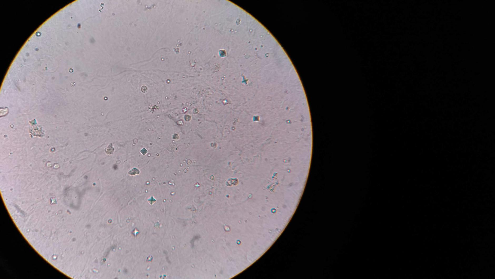 نمای میکروسکوپی باکتری‌های پوست