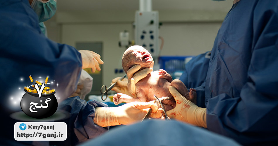 بچه متولد شده از عمل سزارین
