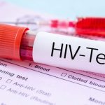 طول عمر شخصی که مبتلا به ویروس ایدز یا HIV است چقدر است؟