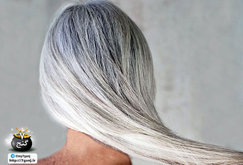 سفیدی مو