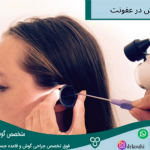 درمان عفونت گوش با ساکشن گوش