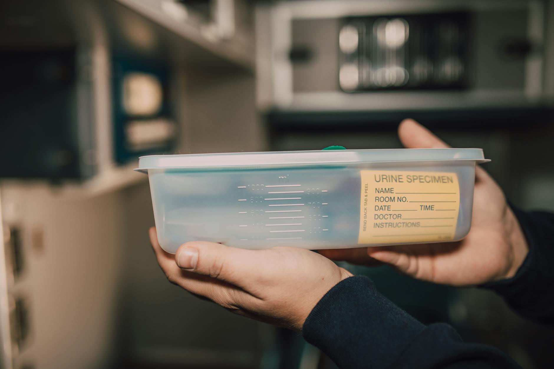 نوار تست آزمایش ادرار و تفسیر رنگ‌ها