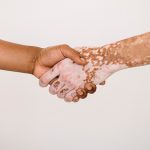 بیماری‌های خودایمنی چیست؟ علائم، علت و راه‌های درمان اختلالات ایمنی بدن