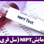 همه چیز درباره آزمایش سل فری (NIPT): تشخیص زودهنگام اختلالات ژنتیکی جنین