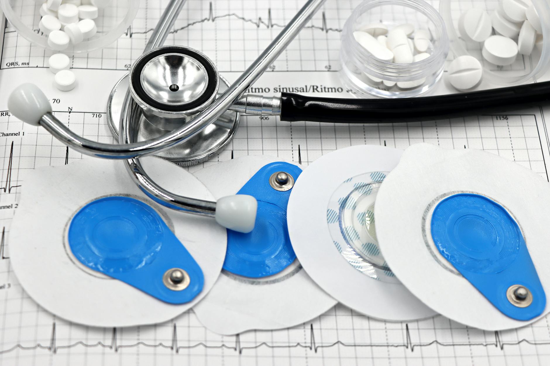 تپش قلب ناگهانی؛ چرا اتفاق میافتد؟ بررسی علتها و زمان مراجعه به پزشک - cardiac arrhythmia ECG monitor